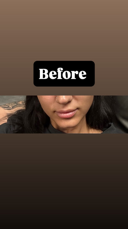 New Lips, Who Dis?™ Needle Free Lip Filler