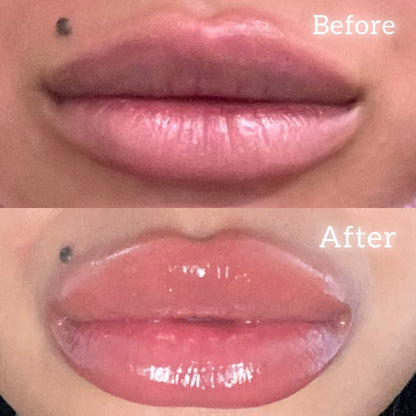 New Lips, Who Dis?™ Needle Free Lip Filler
