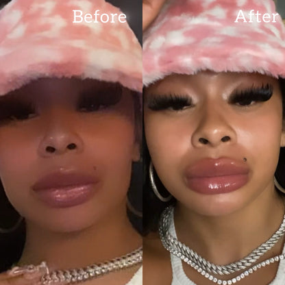 New Lips, Who Dis?™ Needle Free Lip Filler