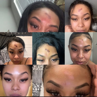 Handmade Facial Acne Cleanser
