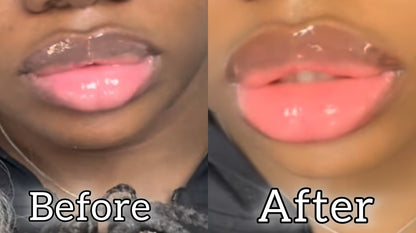 New Lips, Who Dis?™ Needle Free Lip Filler